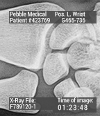 X-Ray Time icon