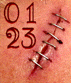 Wound Staples icon
